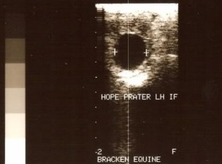 ultrasound