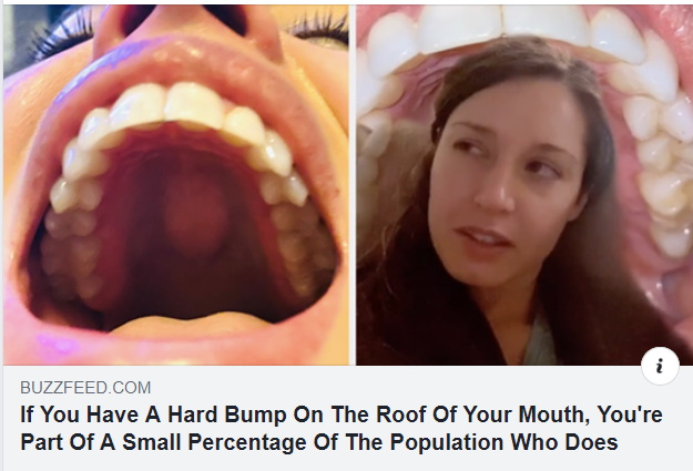 mouthbump
